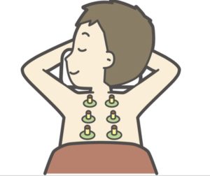 お灸治療